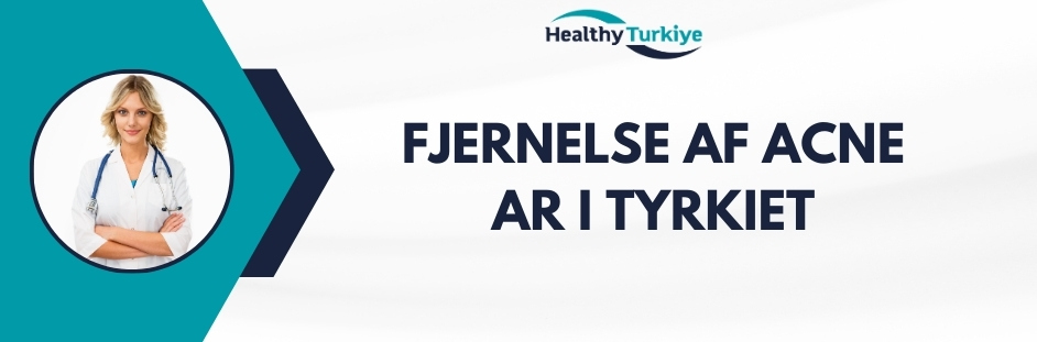 fjernelse af acne ar