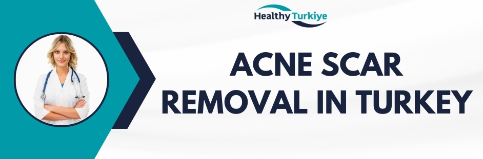 acne scar removal