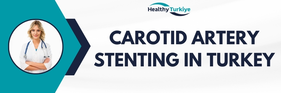 carotid artery stenting