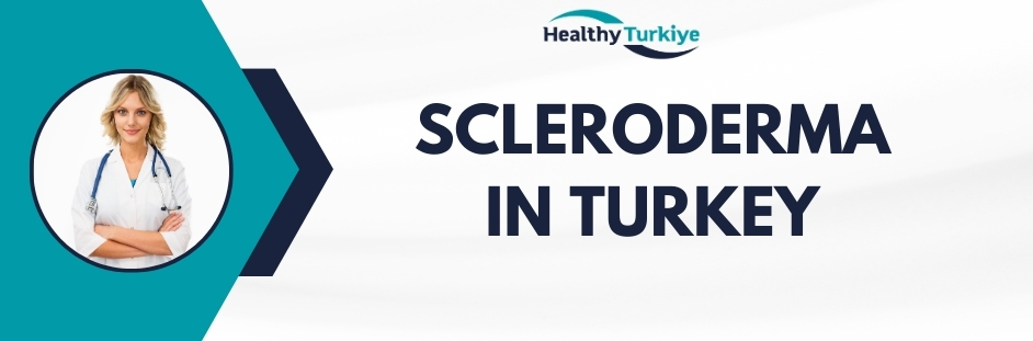 scleroderma treatment