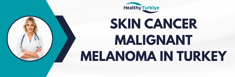 skin cancer malignant melanoma