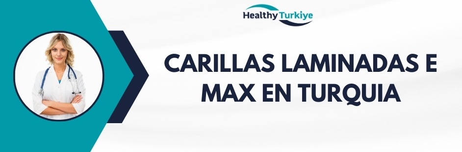 carillas laminadas e max