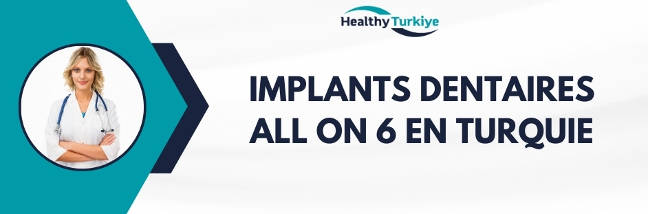 implants dentaires all on 6