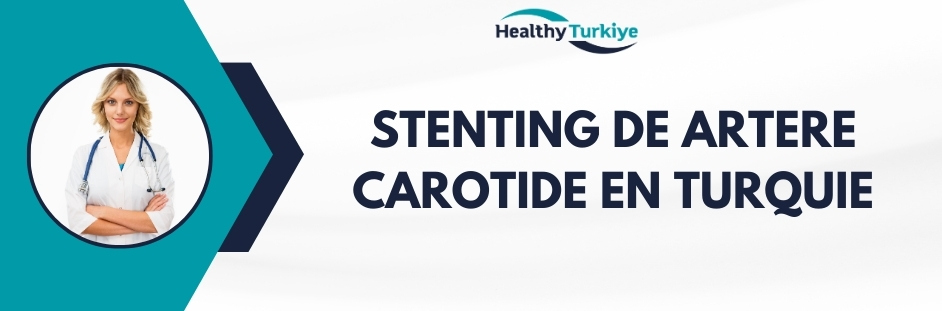 stenting de artere carotide