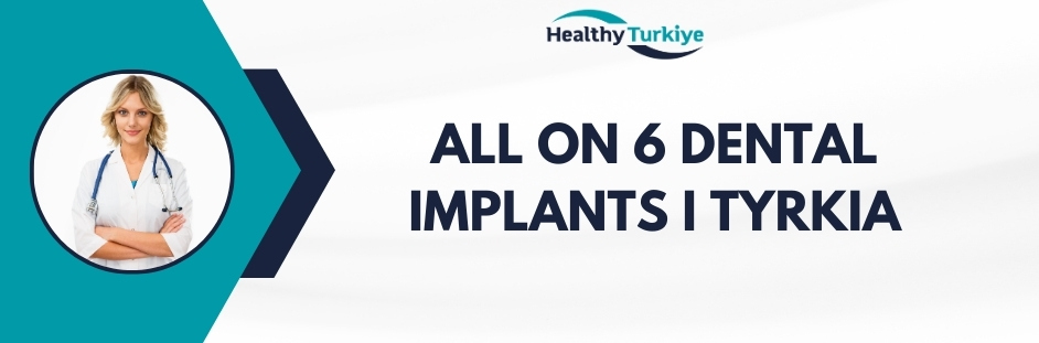 all on 6 dental implants